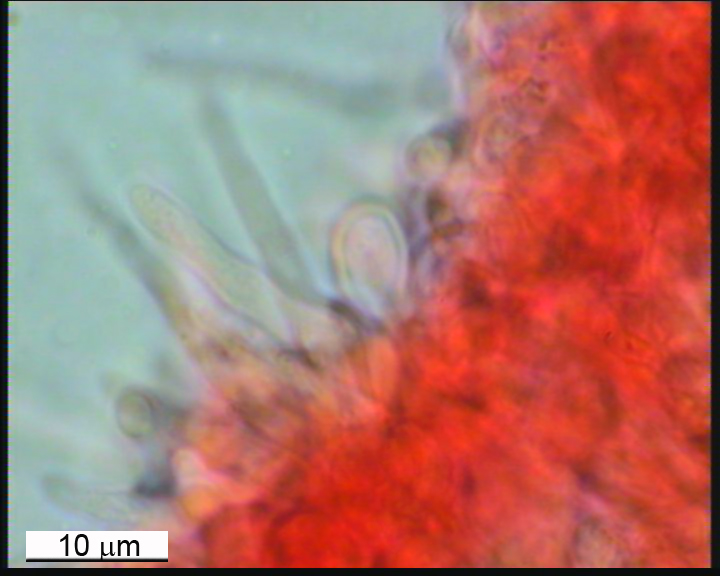 Radulomyces mollaris cistidiado (Radulomyces molaris)